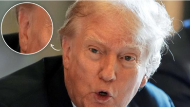 Donald Trump Appears in Public Without Ear Bandage