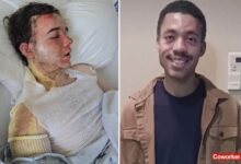 California McDonald’s manager speaks out after coworker threw oil on him California McDonald’s manager speaks out after coworker threw oil on him